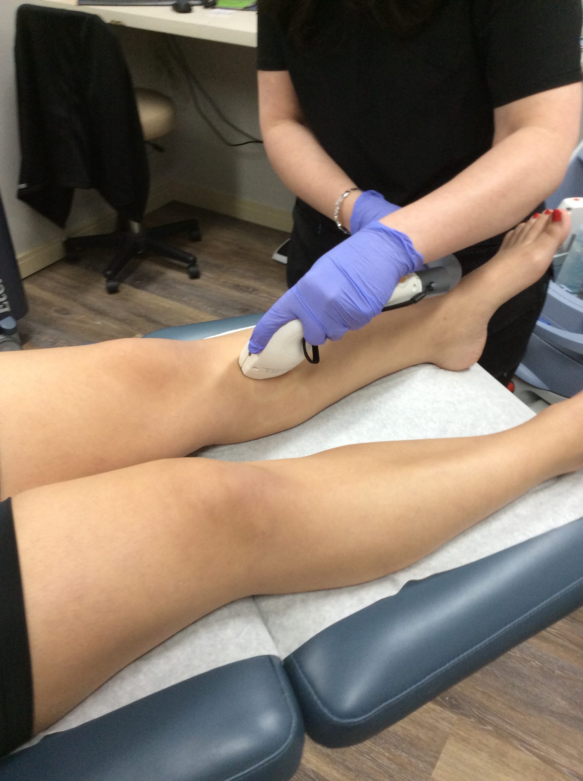 Laser Hair Removal Treatment